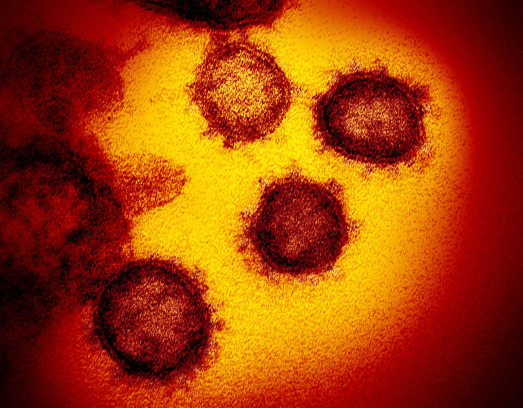 NIAID-RML/ZUMA PRESS/TNS
                                An image from an electron microscope shows SARS-CoV-2, the virus that causes COVID-19. The state Health Department today confirmed that its Laboratories Division has detected the SARS-CoV-2 variant L452R.