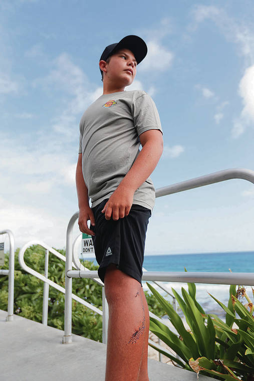 Teen surfer eager to return to ocean following shark bite at Kaneohe ...